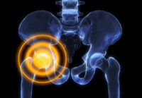 Hip Pain Treatment Guide