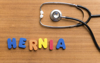 Hernia Treatment Guide