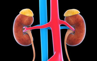 Kidney Cancer Treatment Guide