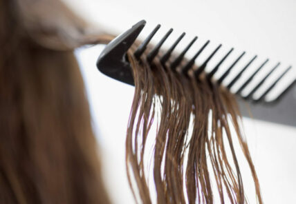 Treatment Options for Hair Loss